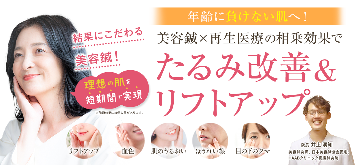 美容鍼を受けたその日に小顔になれたんです。